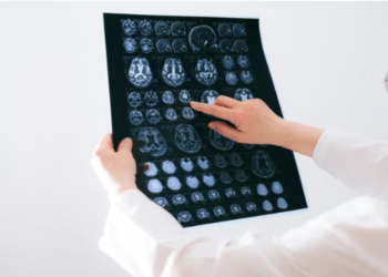 Cada día se detectan en Argentina 5 casos de tumores cerebrales: ¿cuáles son los signos de alerta?