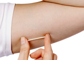 Habrá una jornada de colocación gratuita de implantes subdérmicos