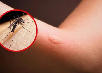 “Dengue hay todo el año así que hay que seguir cuidándose”