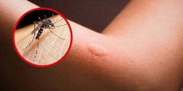 “Dengue hay todo el año así que hay que seguir cuidándose”