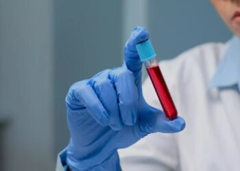 Día Mundial de la Hemofilia: ¿por qué se conmemora el 17 de abril?