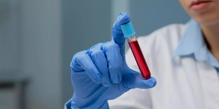 Día Mundial de la Hemofilia: ¿por qué se conmemora el 17 de abril?