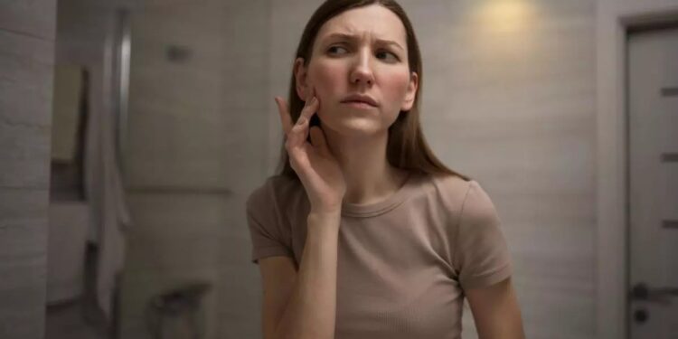 Día Mundial del Lupus: ¿por qué se conmemora el 10 de mayo?