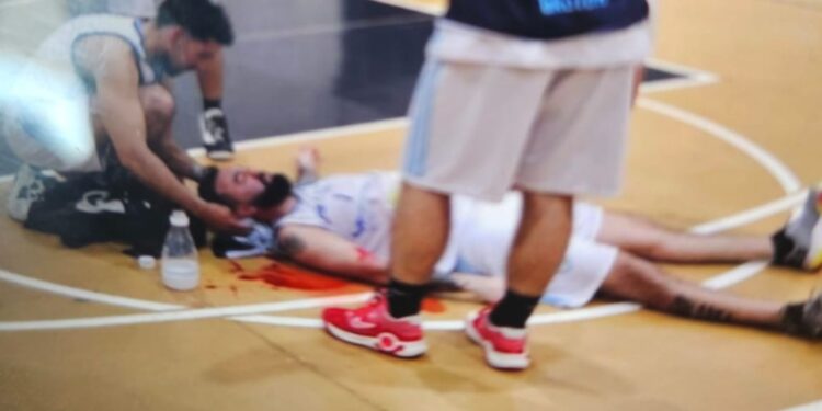 Brutal golpiza en una liga amateur de básquet: casi matan un jugador en Bahía Blanca