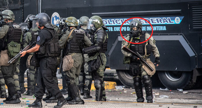 El informe médico forense sobre el ataque a Pablo Grillo «Lesiones gravísimas con riesgo de vida»