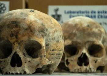 El legado de los neandertales podría explicar una malformación neurológica actual