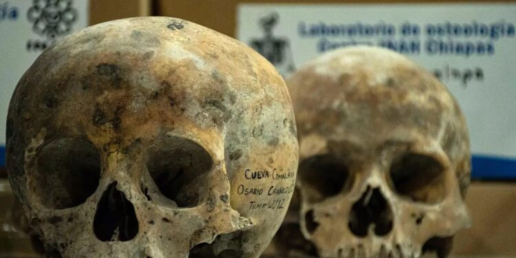 El legado de los neandertales podría explicar una malformación neurológica actual