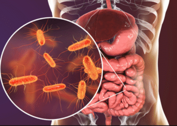 Listeriosis en Argentina: ¿Qué es y cómo prevenirla?