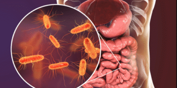 Listeriosis en Argentina: ¿Qué es y cómo prevenirla?