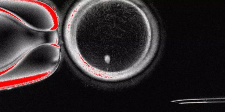 Consiguen por primera vez generar óvulos humanos potencialmente fecundables a partir de células de la piel