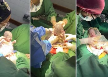 Un caso que sucede cada un millón: nacieron trigemelas en Salta