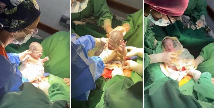 Un caso que sucede cada un millón: nacieron trigemelas en Salta