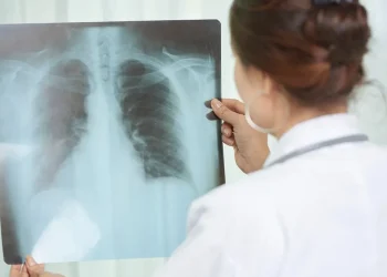 Crecen los casos de Tuberculosis ante la falta de políticas sanitarias: “Los números asustan”