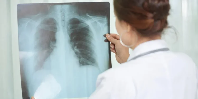 Crecen los casos de Tuberculosis ante la falta de políticas sanitarias: “Los números asustan”