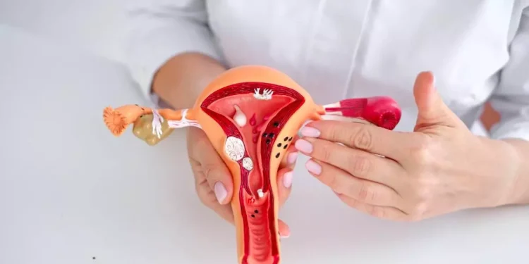 Día Mundial de la Endometriosis: ¿por qué se celebra el 14 de marzo?