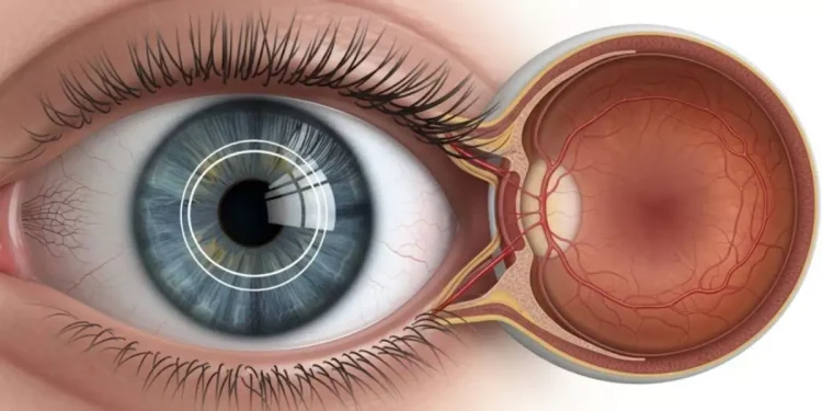 Día mundial del glaucoma: ¿por qué se celebra el 12 de marzo?