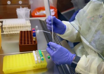 El Hantavirus Andes: Un «Enemigo Local» con Proyección Internacional y Transmisión Aérea
