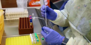 El Hantavirus Andes: Un «Enemigo Local» con Proyección Internacional y Transmisión Aérea