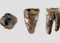 ¿Un dentista neandertal? El orificio en una muela sugiere el primer ‘tratamiento dental’ hace 60.000 años