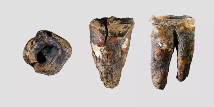 ¿Un dentista neandertal? El orificio en una muela sugiere el primer ‘tratamiento dental’ hace 60.000 años
