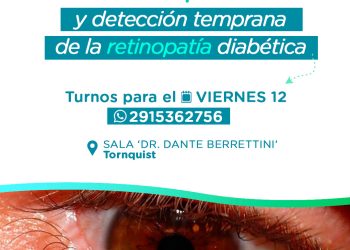 Se agrega una nueva jornada de prevención y detección de retinopatía diabética