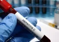 Día Mundial contra la Hepatitis: ¿por qué se conmemora cada 28 de julio?