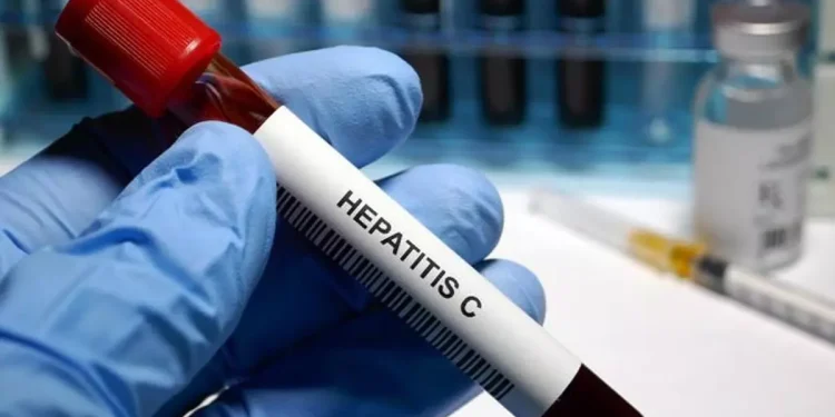Día Mundial contra la Hepatitis: ¿por qué se conmemora cada 28 de julio?