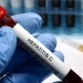 Día Mundial contra la Hepatitis: ¿por qué se conmemora cada 28 de julio?