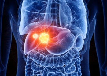 Identifican una nueva vía para potenciar la inmunoterapia contra el cáncer de hígado