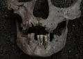 Marcas en los dientes sitúan el primer consumo de drogas de la humanidad hace 25.000 años en Indonesia