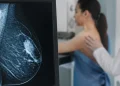 Un estudio argentino revela que el cáncer de mama puede dejar una secuela cardiovascular años después de la remisión