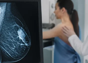 Un estudio argentino revela que el cáncer de mama puede dejar una secuela cardiovascular años después de la remisión
