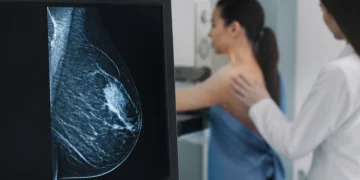 Un estudio argentino revela que el cáncer de mama puede dejar una secuela cardiovascular años después de la remisión