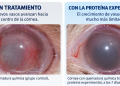 Una proteína experimental evitó que nuevos vasos invadieran las capas profundas de la córnea tras una quemadura química